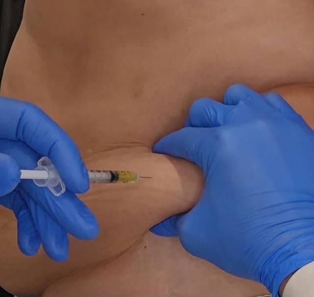 Fat Dissolve Injections