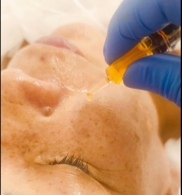 Glycolic Acid Add on