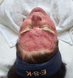 Deep Facial
