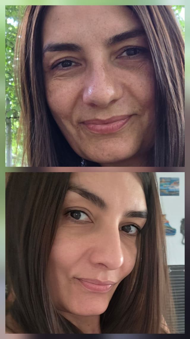 #bespokeantiagingtreatment