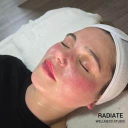 Hannah - Post Facial