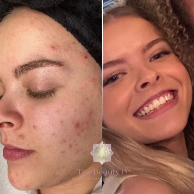 Million dollar skin journey