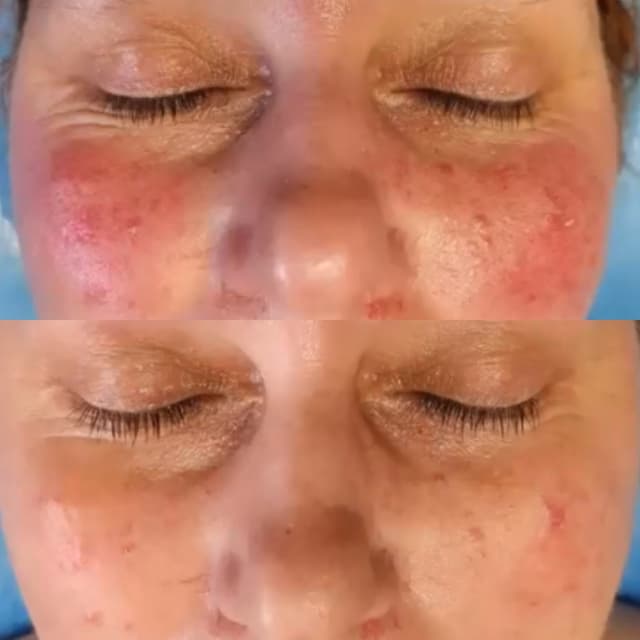 Results after two sessions of Dr Platon one week apart