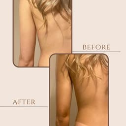 Sienna X Spray Tan- before and after