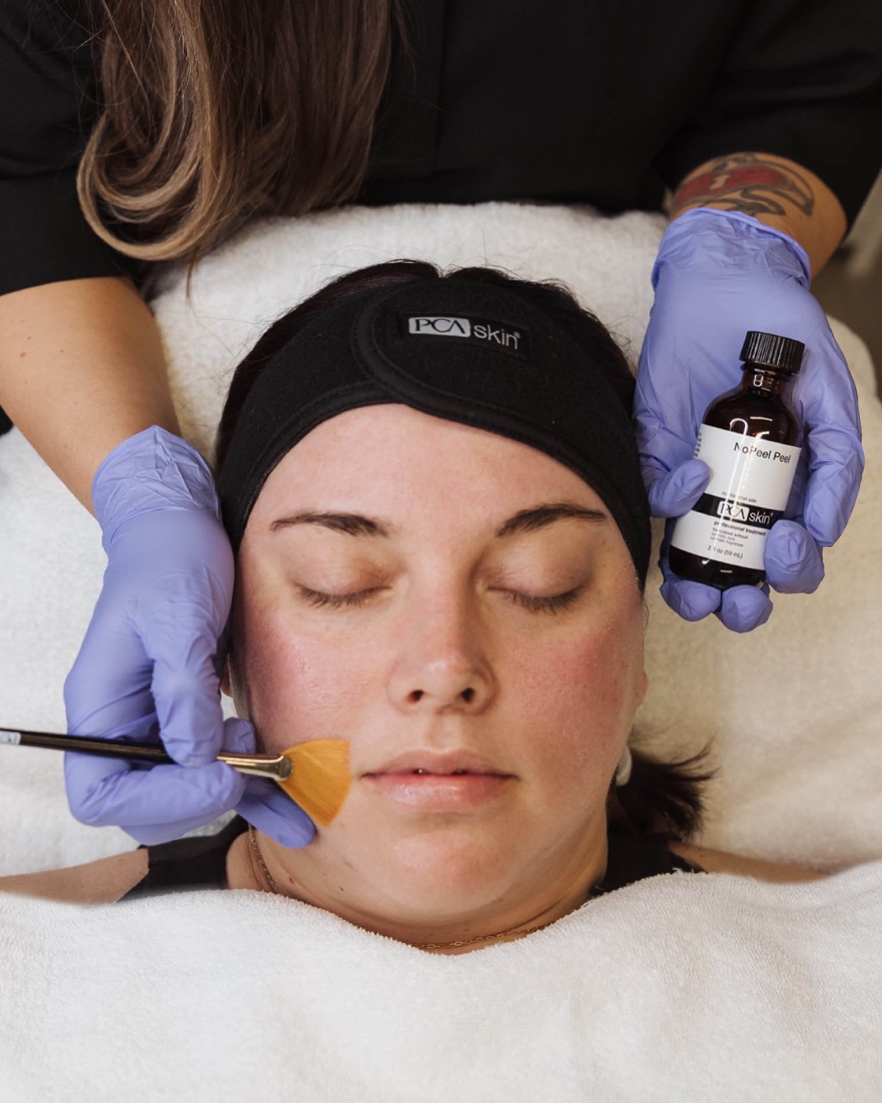 PCA Skin's Pro Peel is tailored to your skins concerns and requirements.
The perfect partnership of hands-on expertise and a combination of corrective capabilities and advanced technologies. 
***Bright + Even Peel*** Boost brightness in just one session! It helps rejuvenate and improve the appearance of breakout prone skin, this gentle peel also brightens and resurfaces to enhance the appearance of skin tone and texture.
***Pigment Correct Peel*** - Address sun damage and melasma with this professional peel. See results in as early as 7 days! + Pigment Gel Pro: Target stubborn dark spots with this at-home corrective. See results in as early as 4weeks!
***NoPeel Peel*** -With no expected visible peeling, the NoPeel Peel encourages exfoliation of the skin, whilst soothing and calming visible redness.
***Deep Pore Peel*** - Clear pores, smooth skin, and reduce sebum production with this gentle and effective pore detoxifying treatment. This Deep Pore Peel delivers instant results, as well as long-term skin-clarifying benefits.
***Advanced Acne Peel*** - This treatment will target two of the most complex and stubborn skin concerns our patients struggle with; hyperpigmentation and acne. This multi-peel customised approach allows us to target both hyperpigmentation and acne simultaneously.