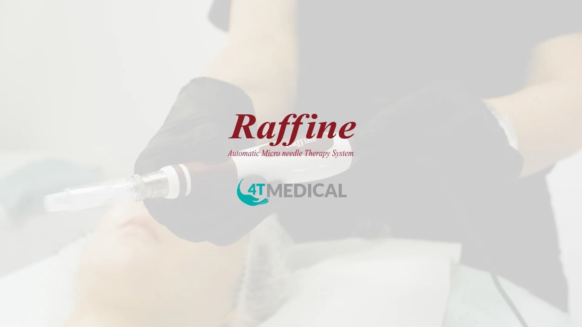 Microneedling (collagen induction therapy) is a minimally invasive cosmetic procedure using fine, sterile needles to create micro-punctures in the skin. This triggers a natural healing response, stimulating collagen and elastin production to reduce acne scars, wrinkles, fine lines, sun damage, and enlarged pores. It is safe for all skin tones and typically requires 3–6 sessions for best results.