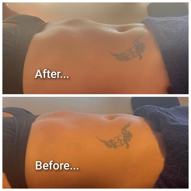 Brazilian lymphatic drainage