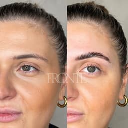 Brow Lamination before and after Manchester