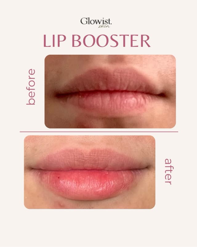 Lip booster