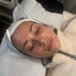Dermaplane & chemical peel