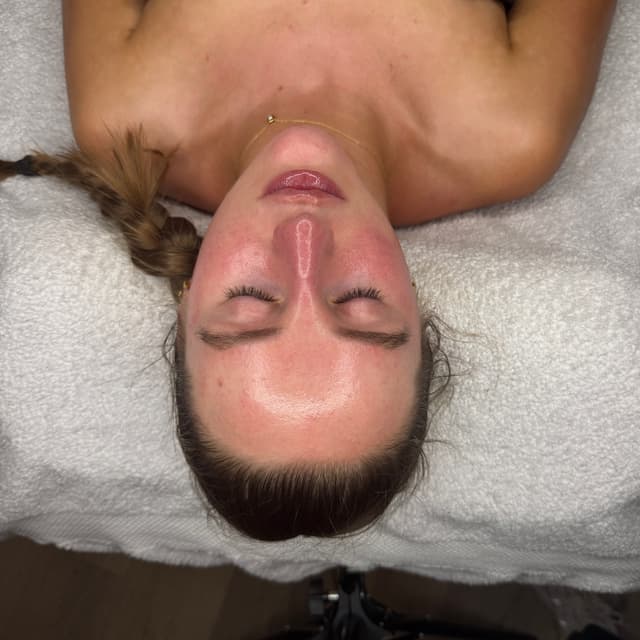 Dermaplaning
