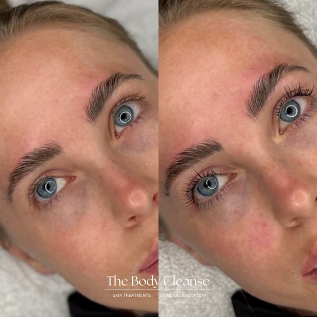 Lash lift