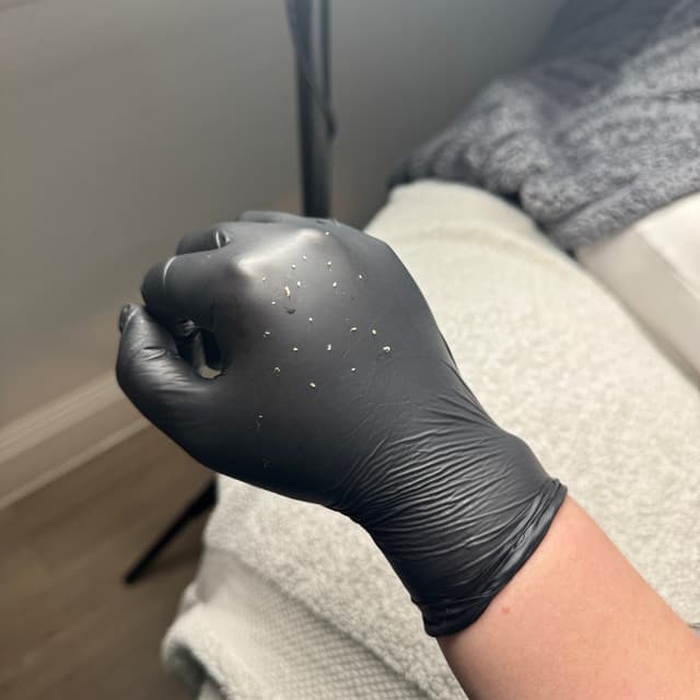 Extractions 🤪