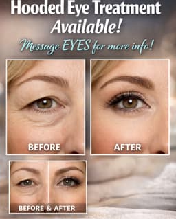 Hooded eye treatment