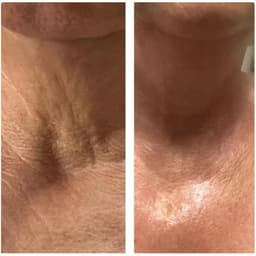 Pre and post polynucleotides