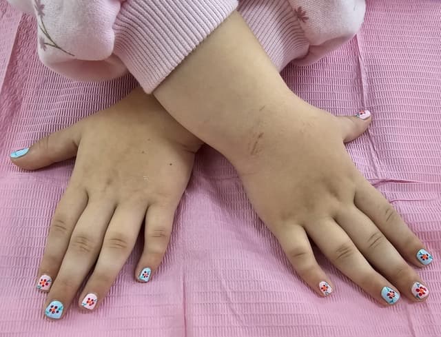 Kids nails