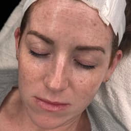 Mama-To-Be-Facial