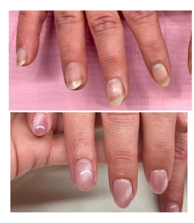 Before & After
