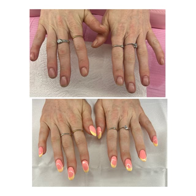 Before & After