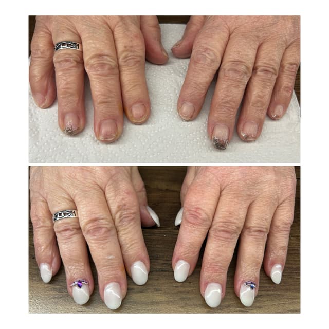 Before & After