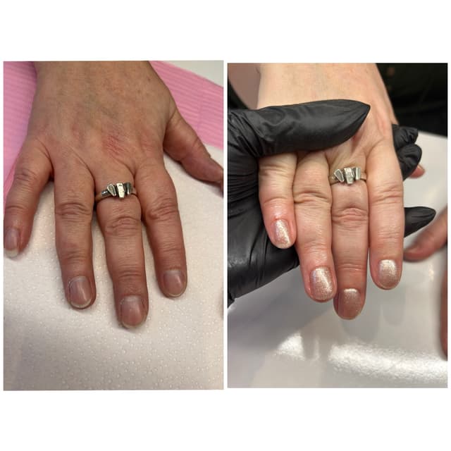 Before & After