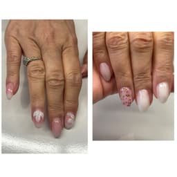 Before & After 3 weeks infill