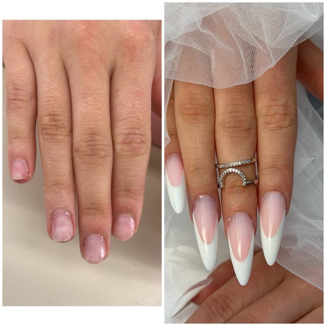 Before & after
