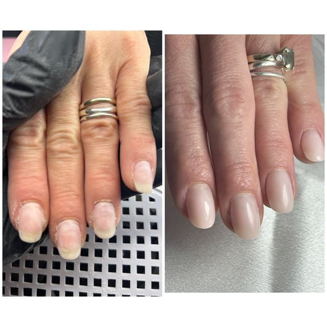 Before & after