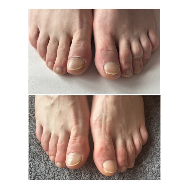 Basic pedicure