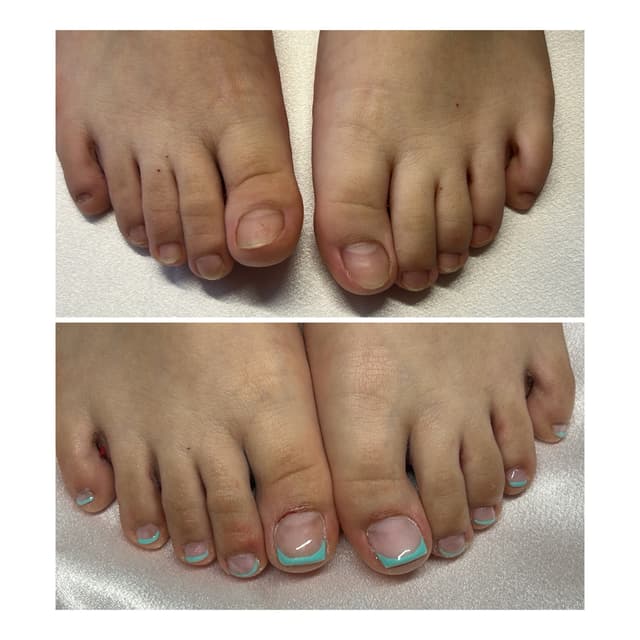Before & after