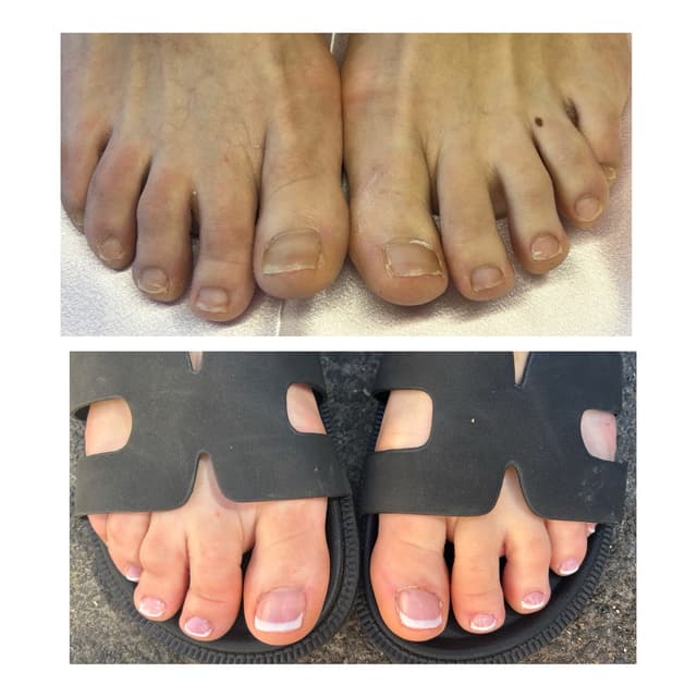 Before & after