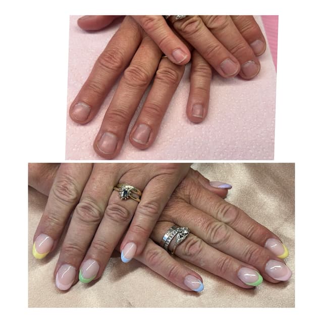 Before & after