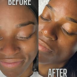 Classic Facial before and after