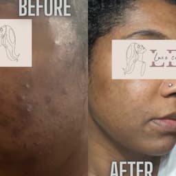 BioRePeel before and after