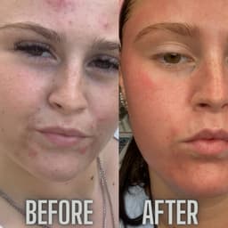 My personal before and after