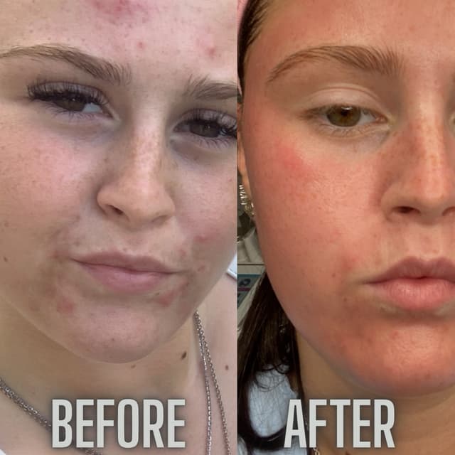 My personal before and after