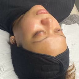 Hydro Facial