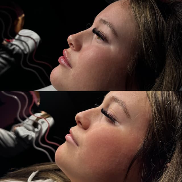 Side Profile Package