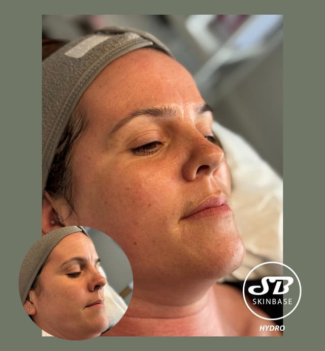 Hydrofacial - Brightening serum