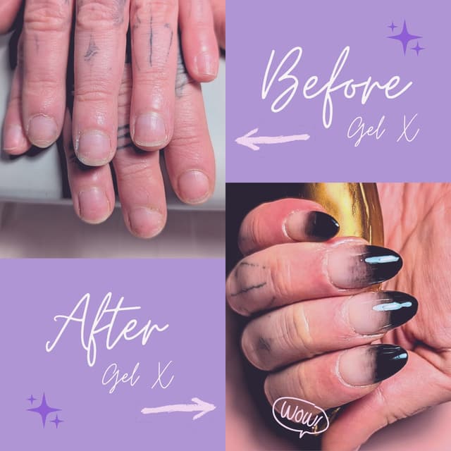 Gel X transformation - before & after