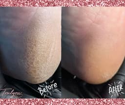 E-Pedi - advanced hard skin removal