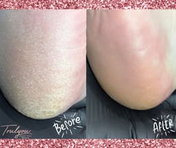 E-Pedi - advanced hard skin removal