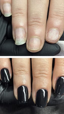 Amazing nail growth