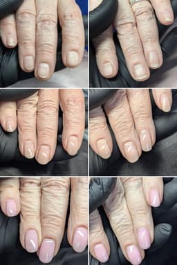 Nail growth progress