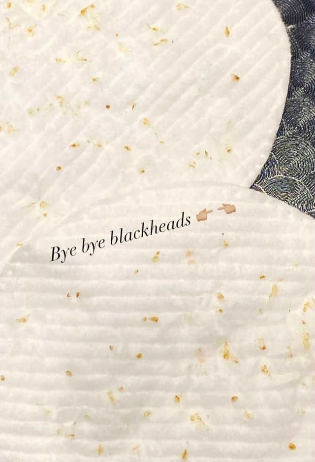 pore extraction results