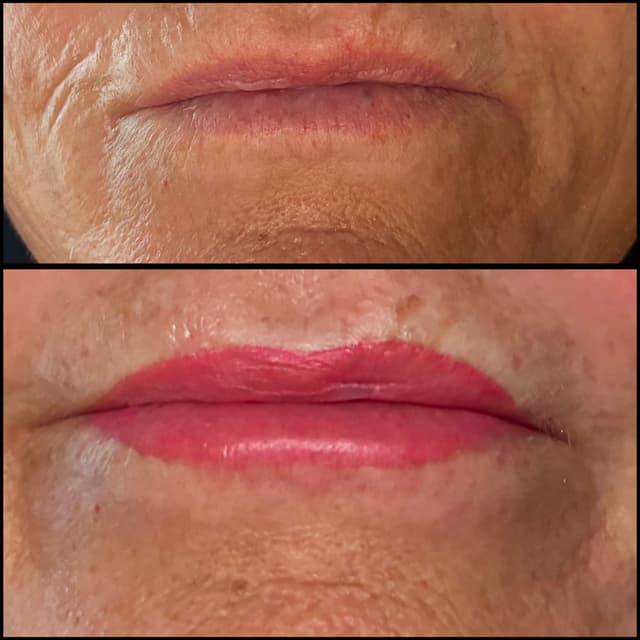 Lip Blush before + After