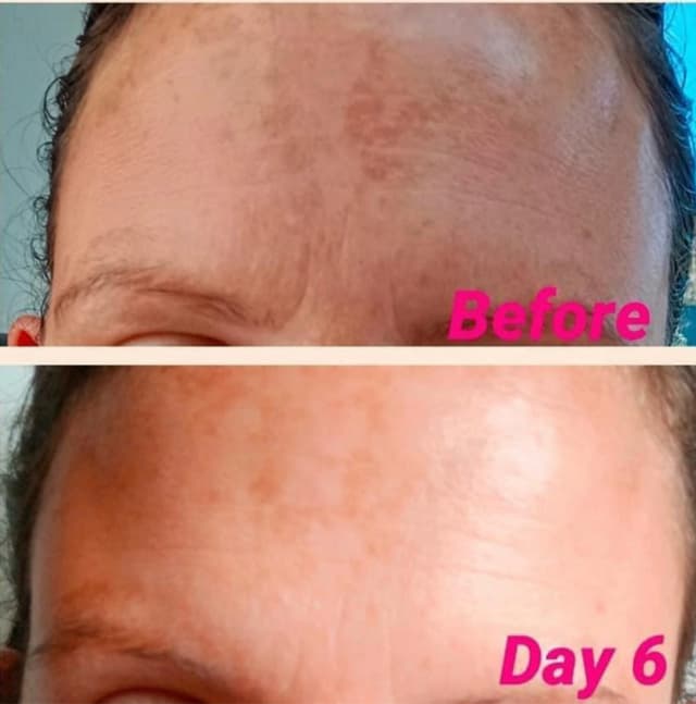 Using Glow Berry twice a day