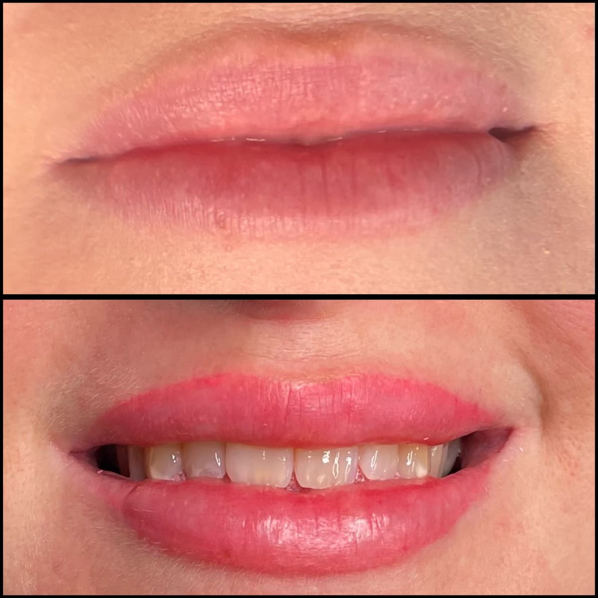 Lip Blush - **£270.00**
Lip blush can be as natural or as bright as you would like it to be! you can have it to define symmetry to lips. Have an everyday lipstick effect to match your favourite colour shade. Refine the lip border, camouflage scars and bring some pigment back to the lips.