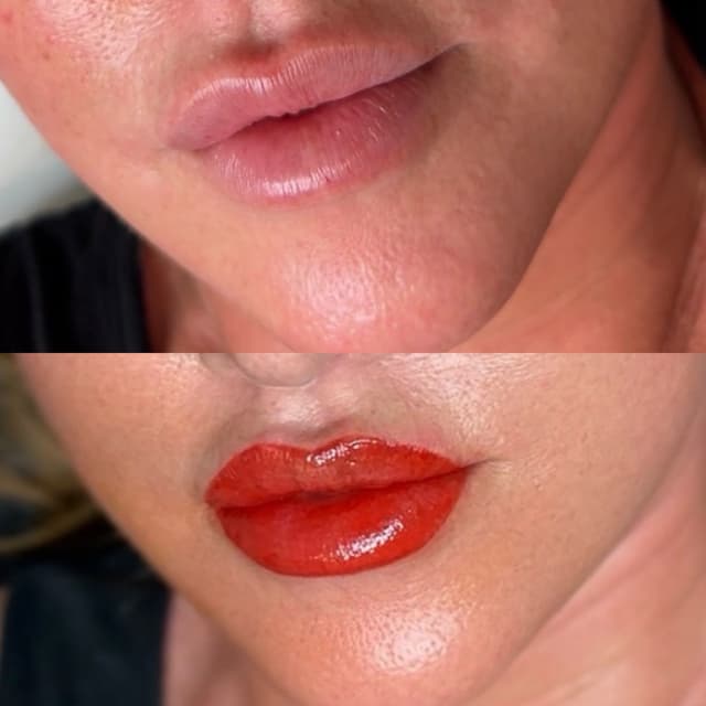 Before and After Lip Blush