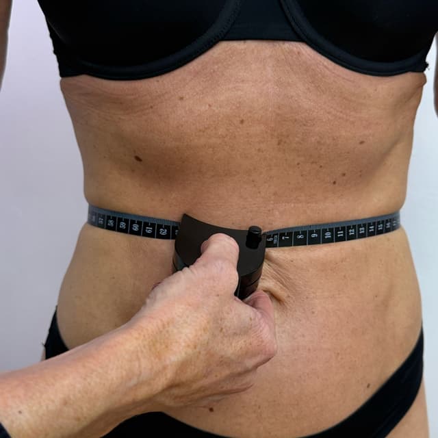 Wood Therapy After -5cm